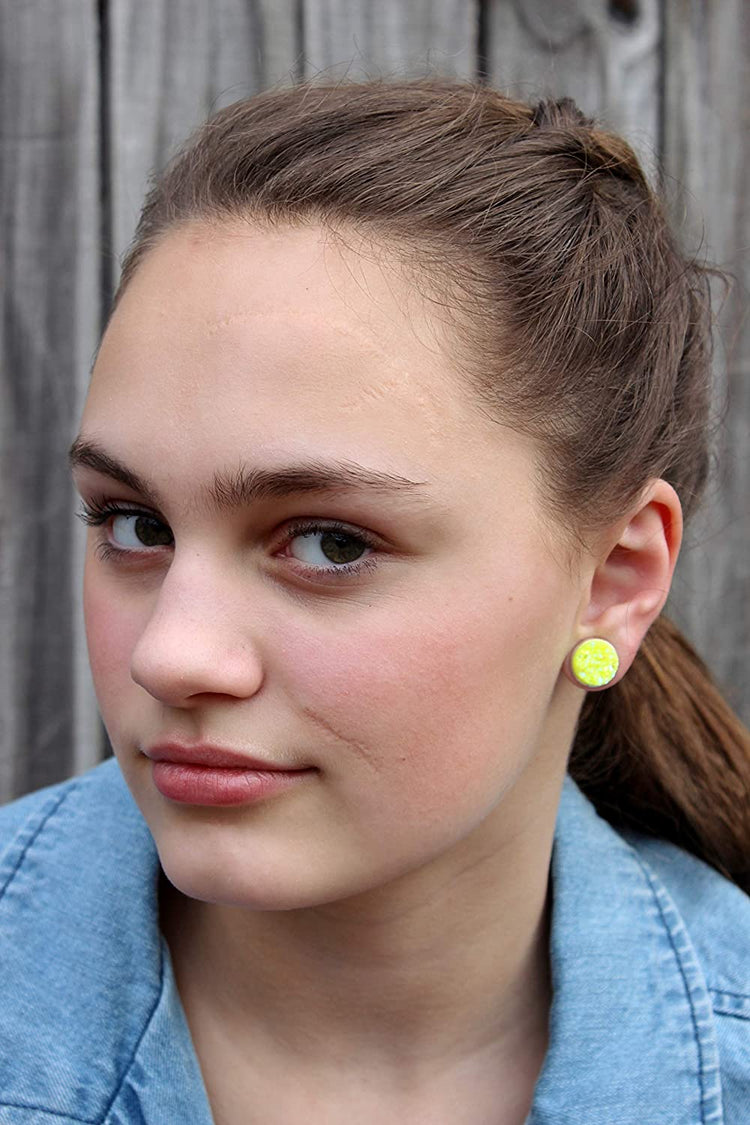Silver-tone Neon Yellow AB Faux Druzy Stone Stud Earrings 12mm